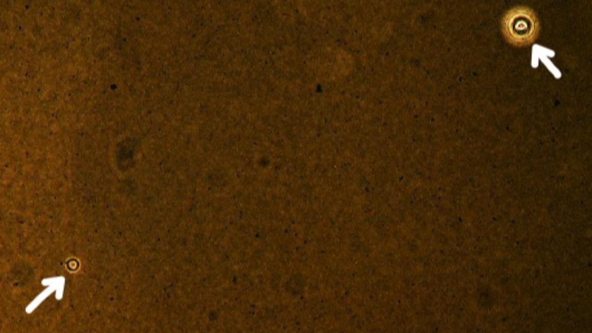 台中一名林姓退休教師，因隱球菌（箭頭處）引起腦膜炎，僅3週退化到臥床狀態。（圖／台中榮總提供）