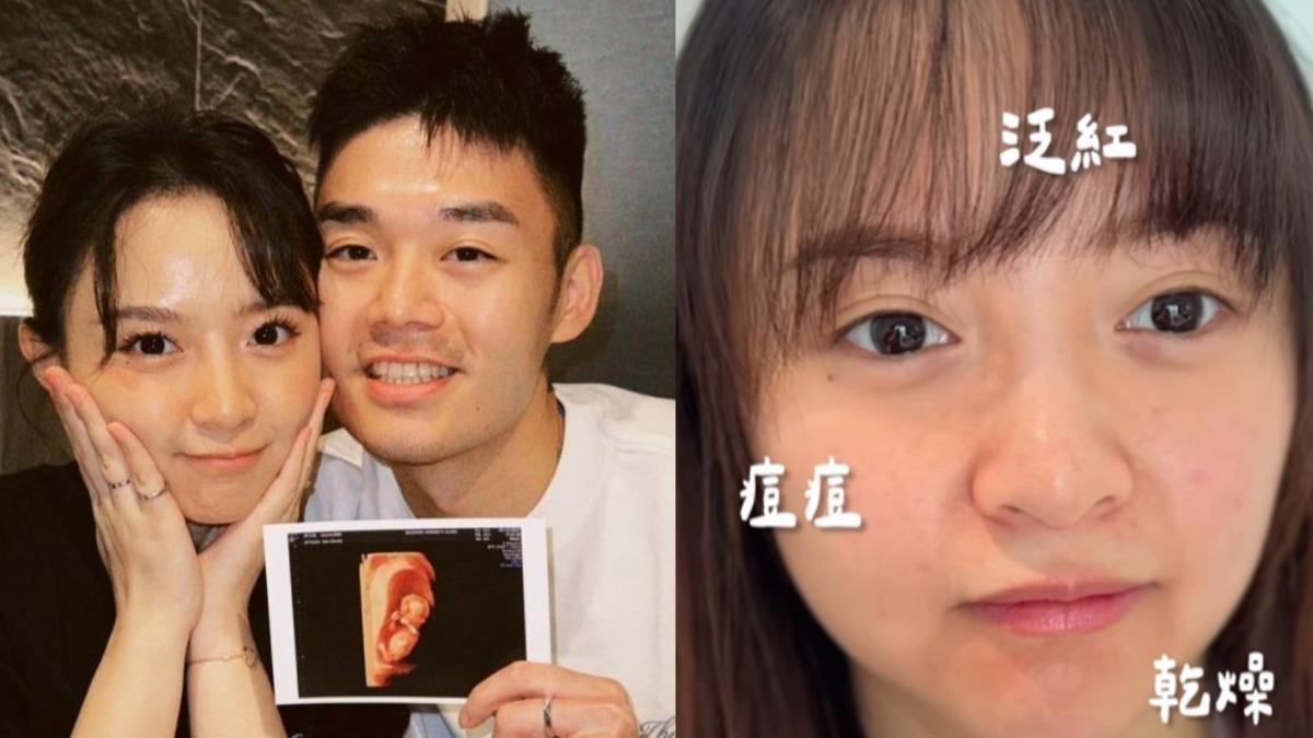 十元和王齊麟做人成功，但十元膚況變差。(圖／翻攝自10yuan.0424 IG）