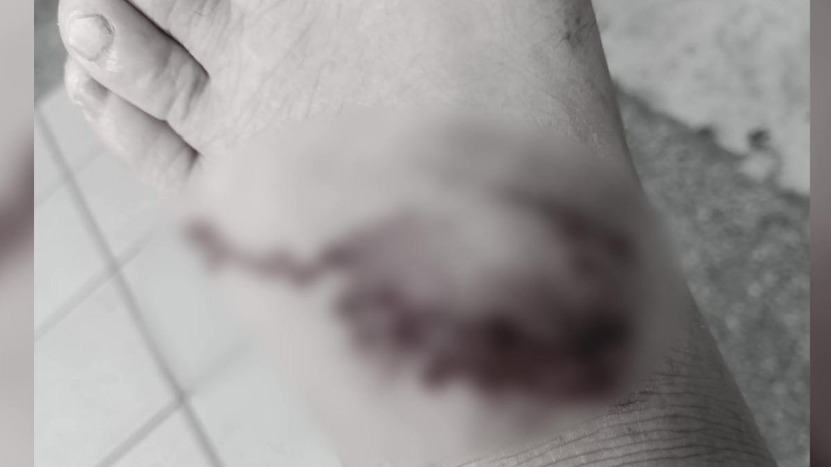 太平山區爆狗群「追車咬人害慘摔」調監視器究責