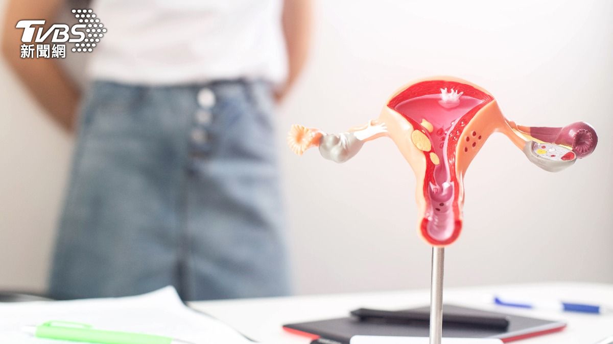 第三期子宮內膜癌非末期！醫曝治療關鍵：患者可存活超過5年