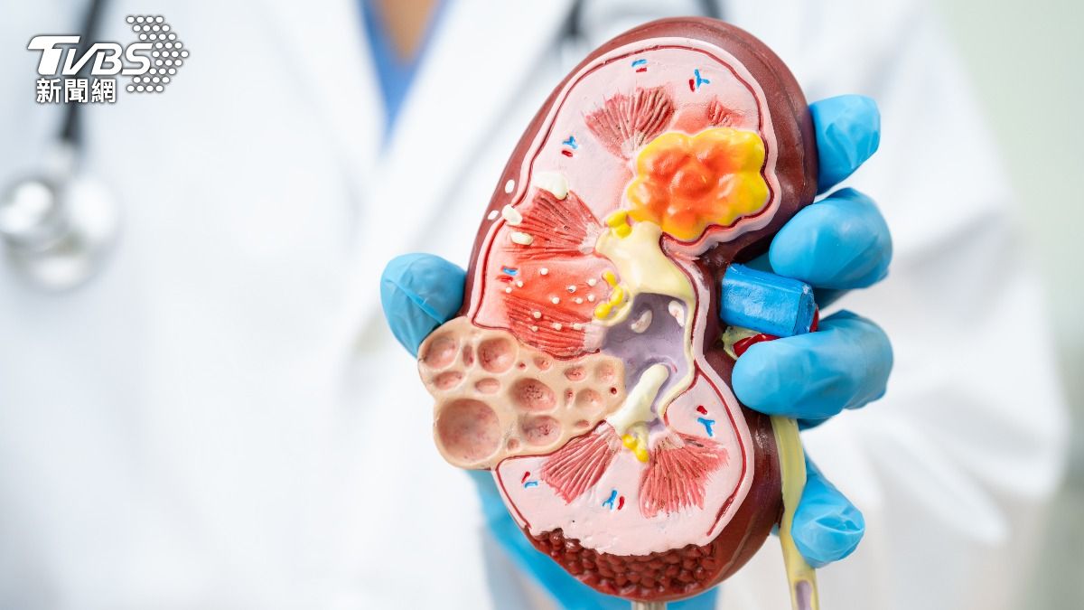慢性腎臟病3年惡化!不是吃太鹹 醫揭傷腎3大禍首