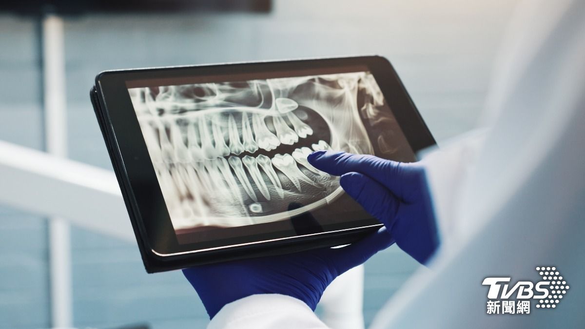 日研究找出「牙齒再生」關鍵幹細胞 缺牙未來有望長出真牙