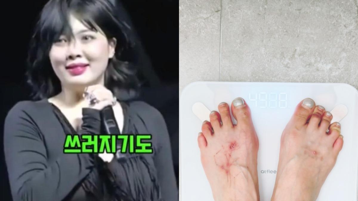 最新體重曝！泫雅鏟肉1個月太猛　腳上嚇人傷疤「疑為圓母親夢」