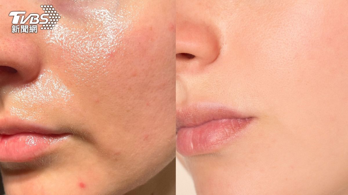 油肌必看!3款吸油神器網激推 「李時安愛用款」不到300元