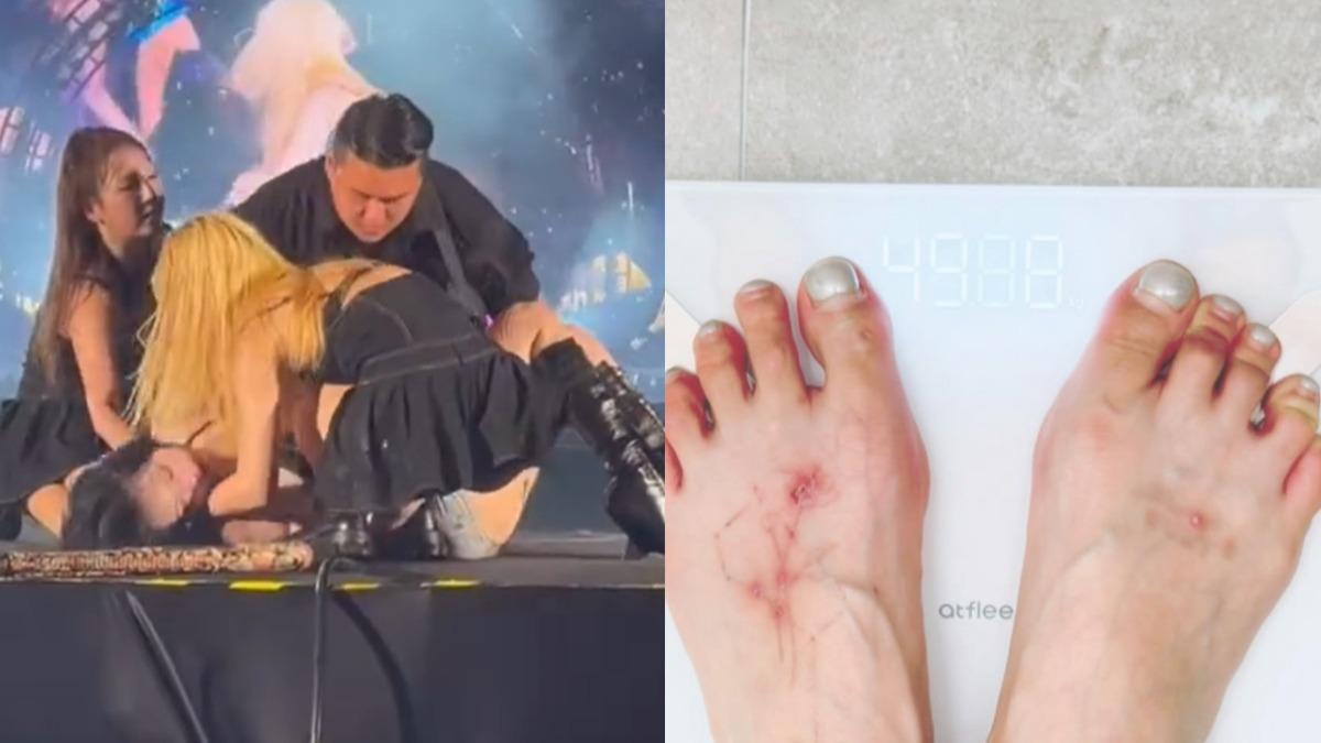 1個月爆瘦10公斤!泫雅才宣布體重減回4字頭 開唱突當場暈倒