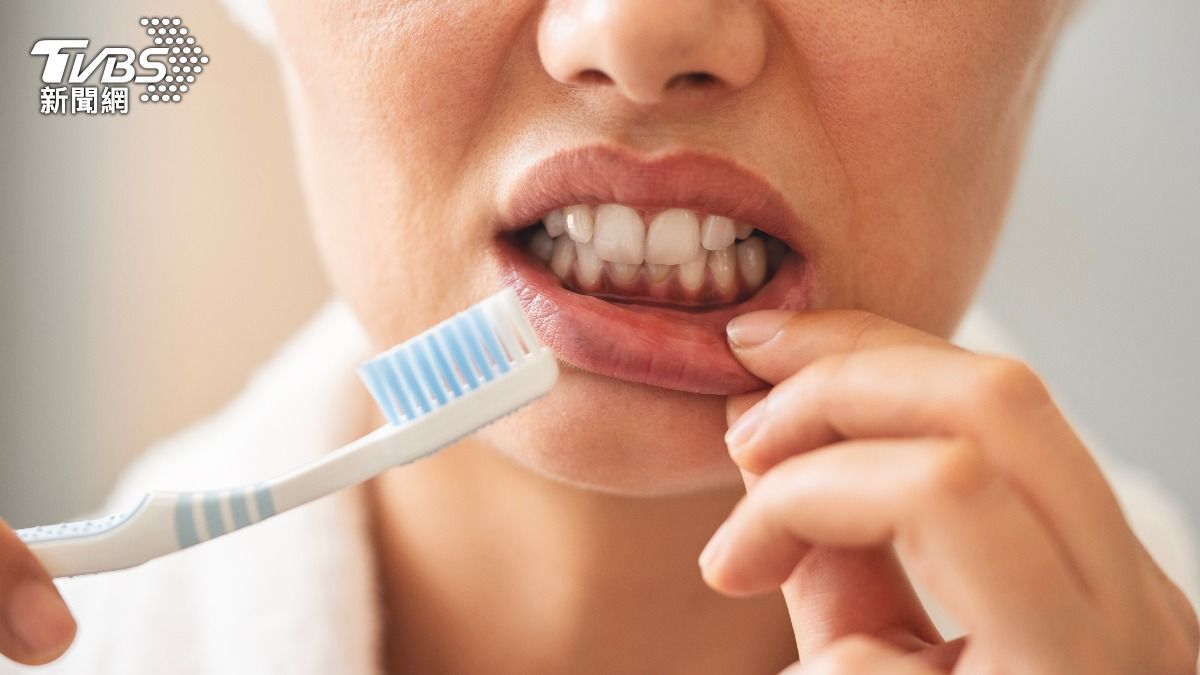 沒刷好牙會傷心!動脈斑塊暗藏「口腔1細菌」 成心臟病推手