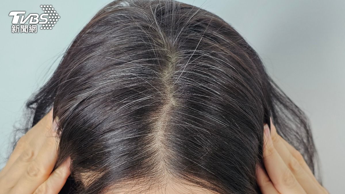 白髮遮得巧更減齡!不同程度染法一次看 「這方法」比染黑有效