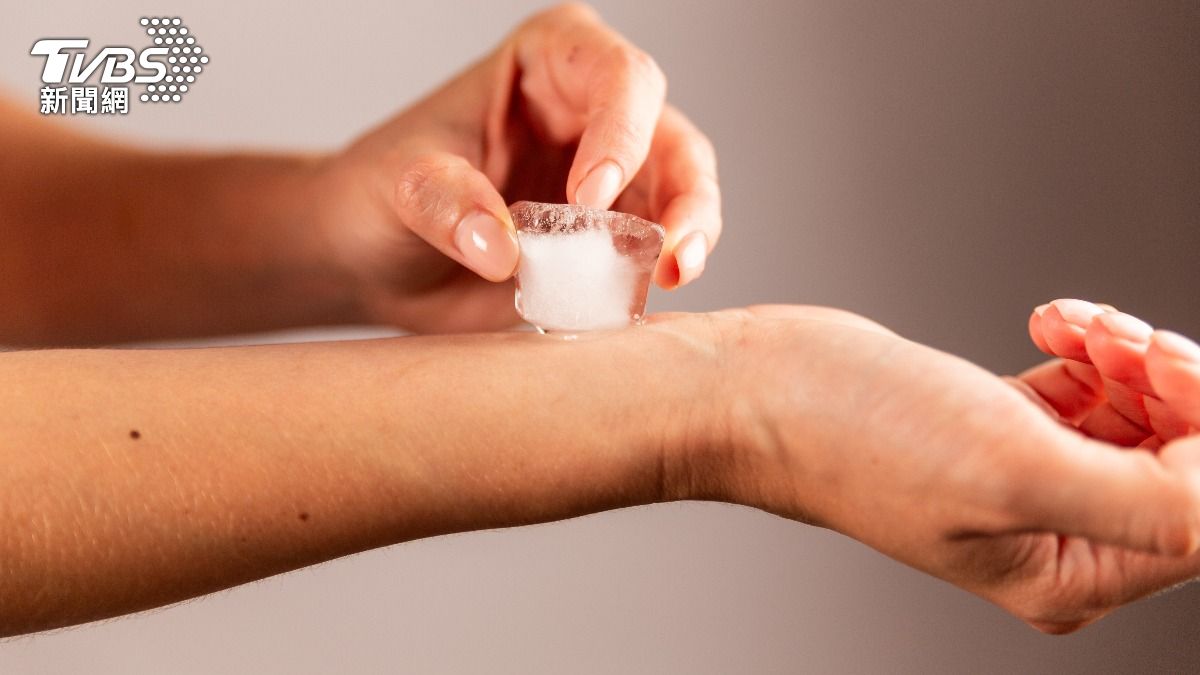 火燒身別亂跑！1動作「助長火勢」　醫：冰敷恐害組織壞死