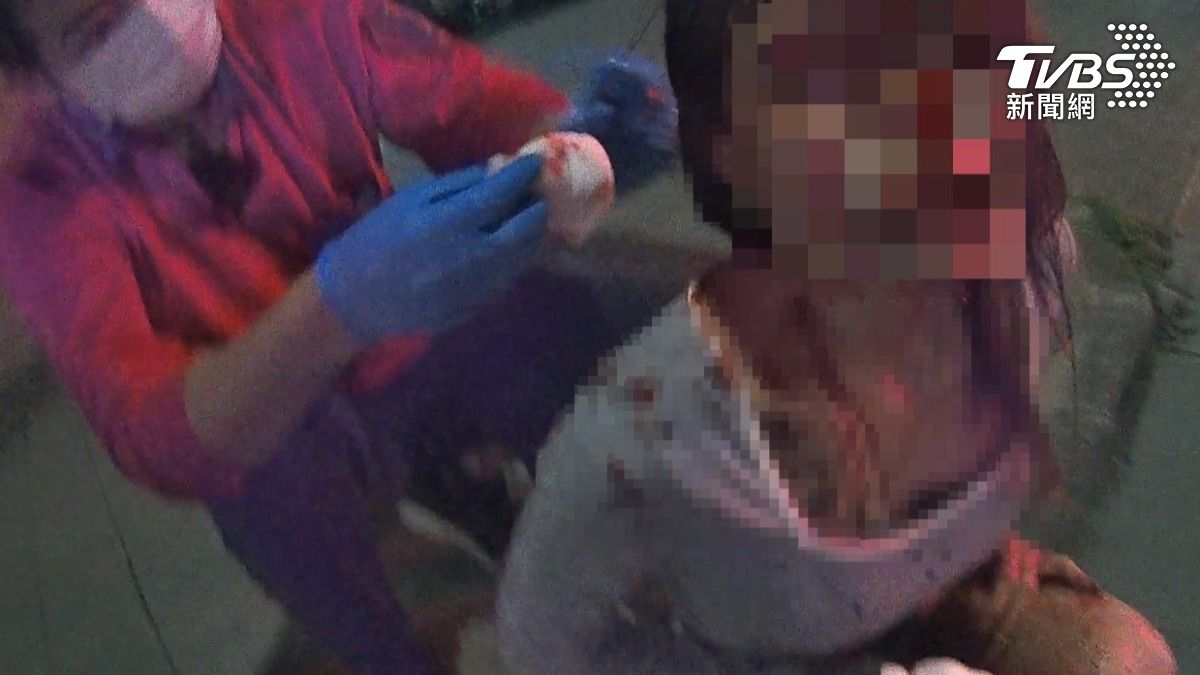 快訊/嘉義恐怖自撞!19歲女「滿面是血」痛呼:我流好多血