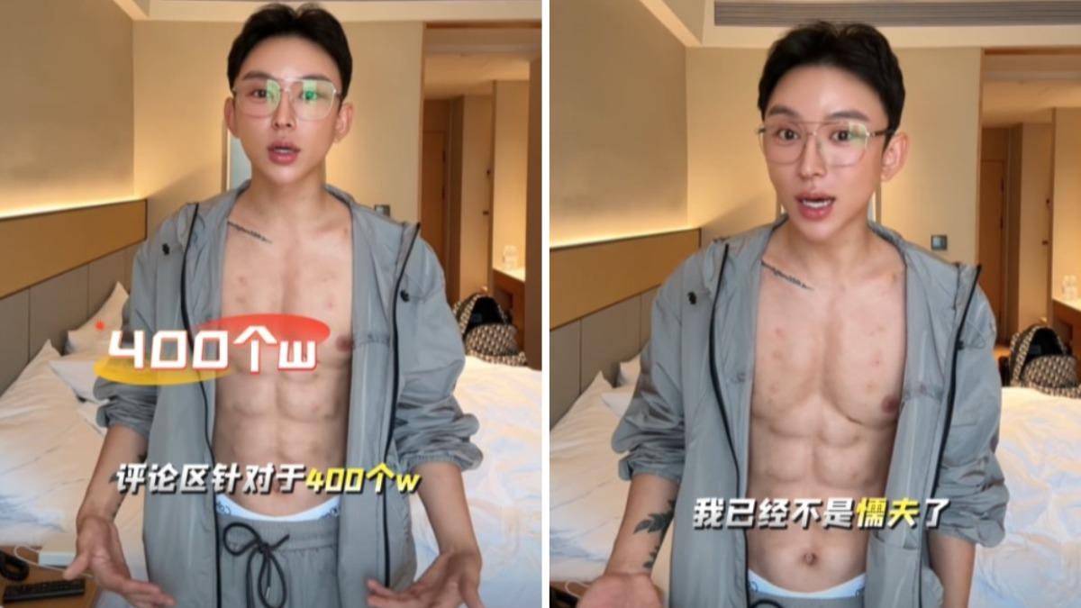 陸網紅砸千萬打造人工八塊肌!被酸「形狀像腫瘤」 醫曝風險
