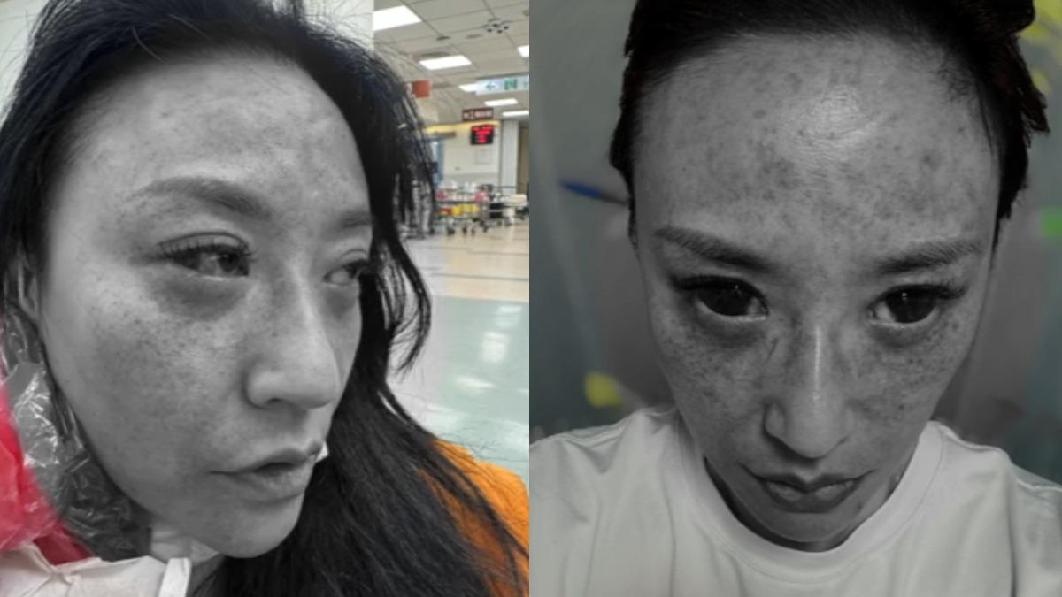 控國手尪出軌+家暴!安歆澐「車裡被掐脖、眼睛充血」請求饒命