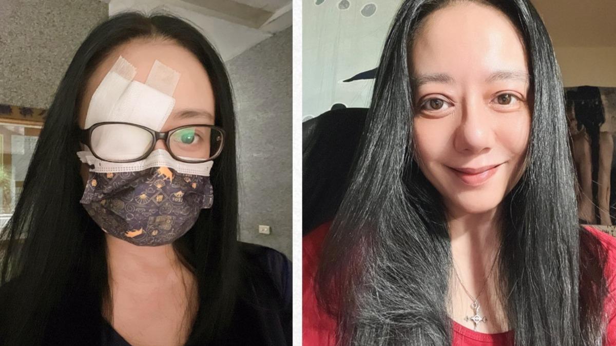 高慧君恐失明！緊急「3次開刀」嘆：已最壞打算