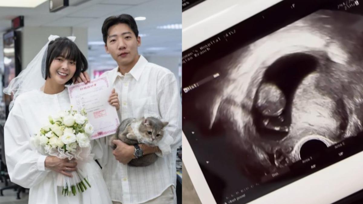 曾被判不孕!小豬黃沐妍揭子宮「嚴重沾黏像起司」 突當媽喊神奇