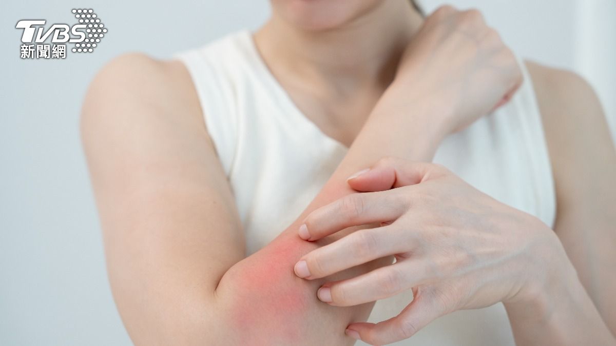 冬季乾癢高峰來襲！醫揭3大保濕關鍵　「不當護理」恐釀皮膚炎