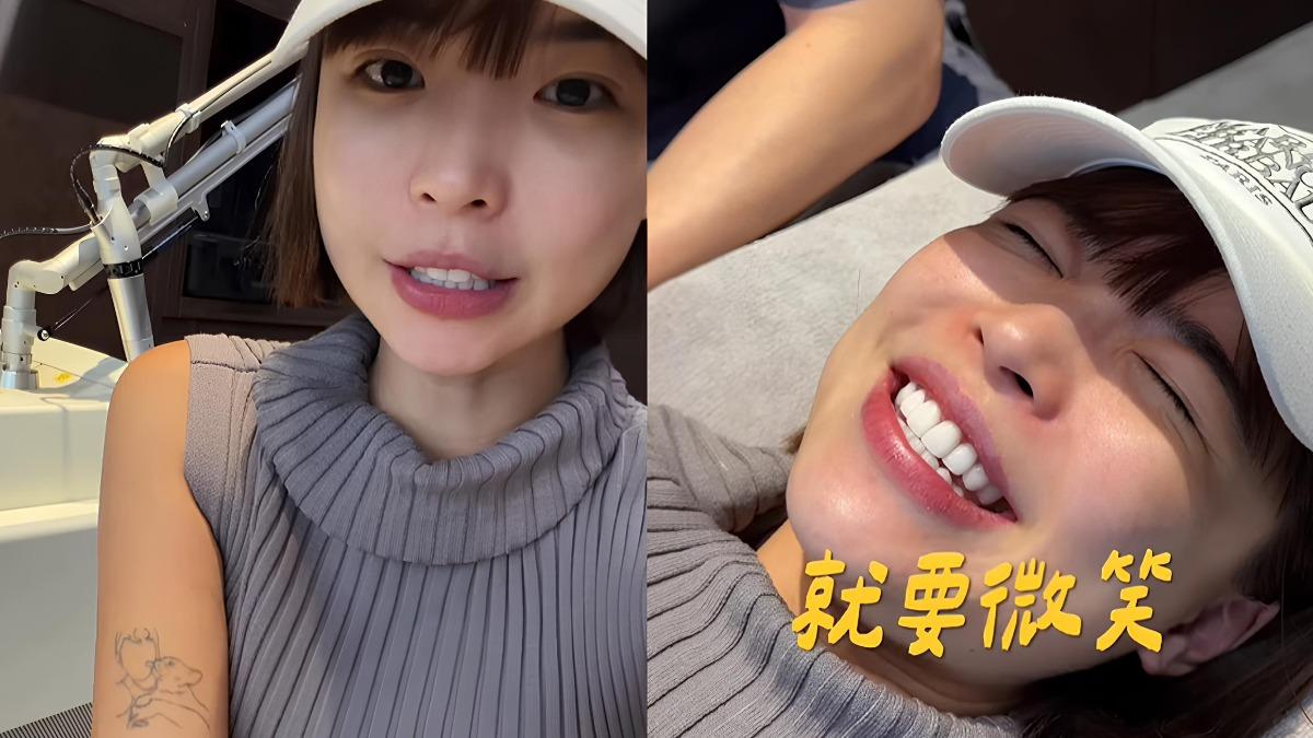 YTR阿圓除刺青過程全被拍！曝為何去除「愛犬」真實原因