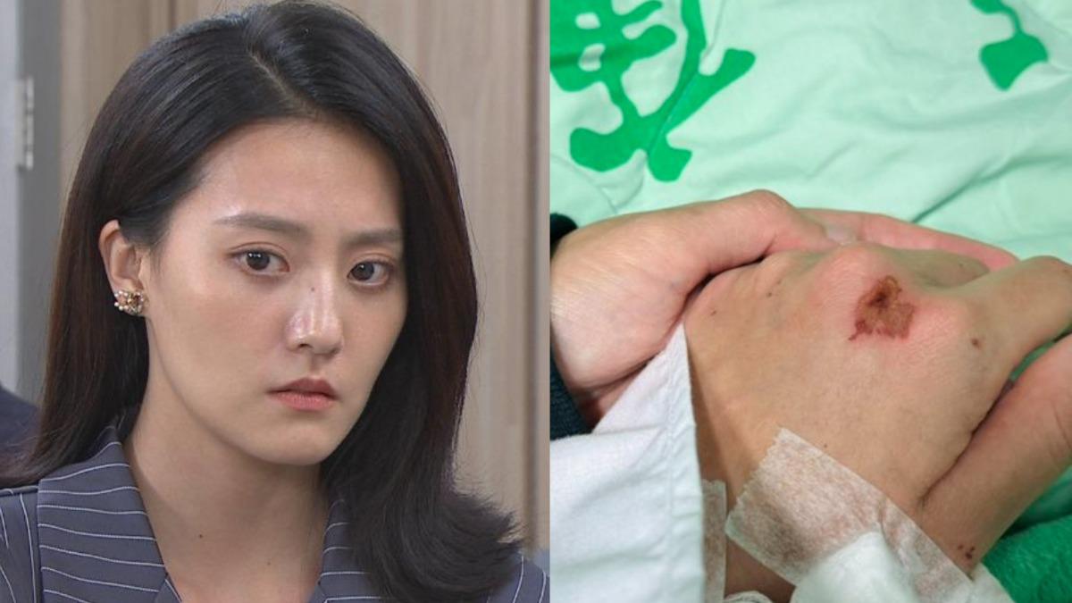 八點檔女神車禍重傷!悲吐崩潰心聲 向她致歉:無法陪你到最後
