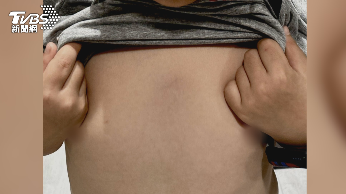 6歲童胸口瘀青！　家長怒控補習班師肘擊　業者力挺師