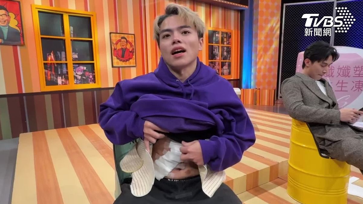 海產捐肝救父！曝光術後「腹部L字型傷口」喊：這是光榮的象徵