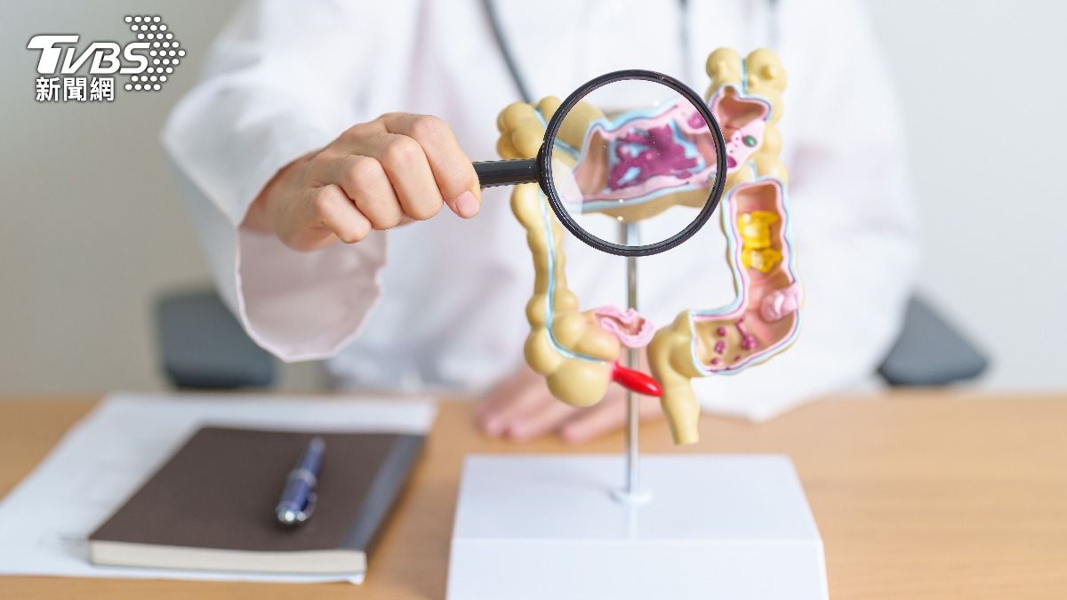 不是小毛病!男健檢「1常見症狀」竟大腸癌 醫:這些都是警訊