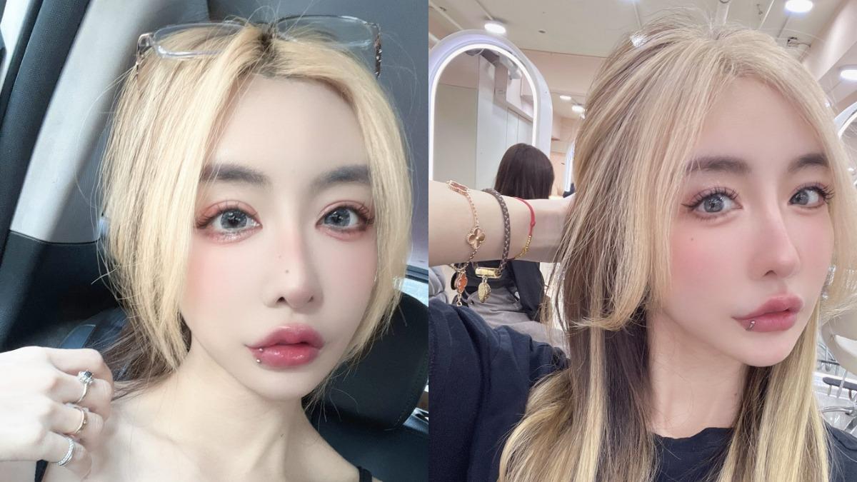 整形後遺症釀禍！雪碧痛到崩潰「像用針插進眼睛」：已經受不了