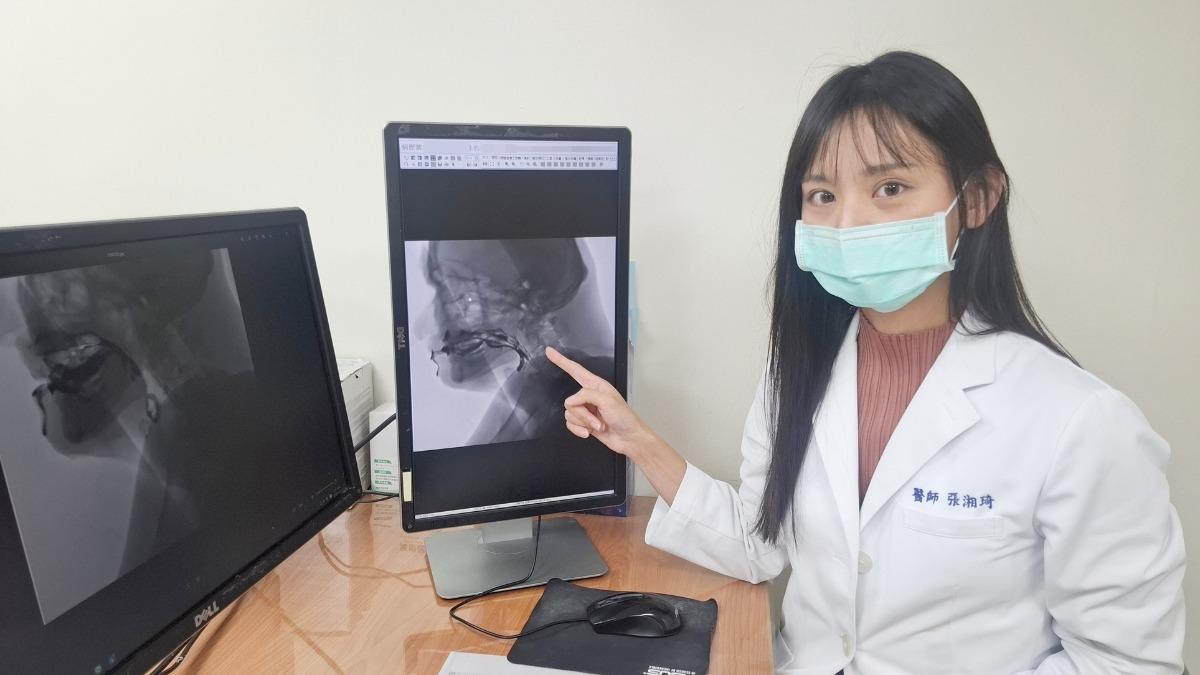 喝水嗆到也會死！鑽石歌王、李登輝都因「老人殺手」病逝　醫急示警