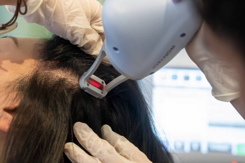 告別頭皮危機！吳依霖搶先體驗愛爾麗「拉髮密雷射」強調：頭皮健康才是秀髮根本！