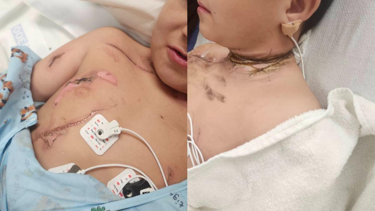 美8歲童睡夢翻身「項鍊卡插座」遭電擊　關鍵動作救回1命