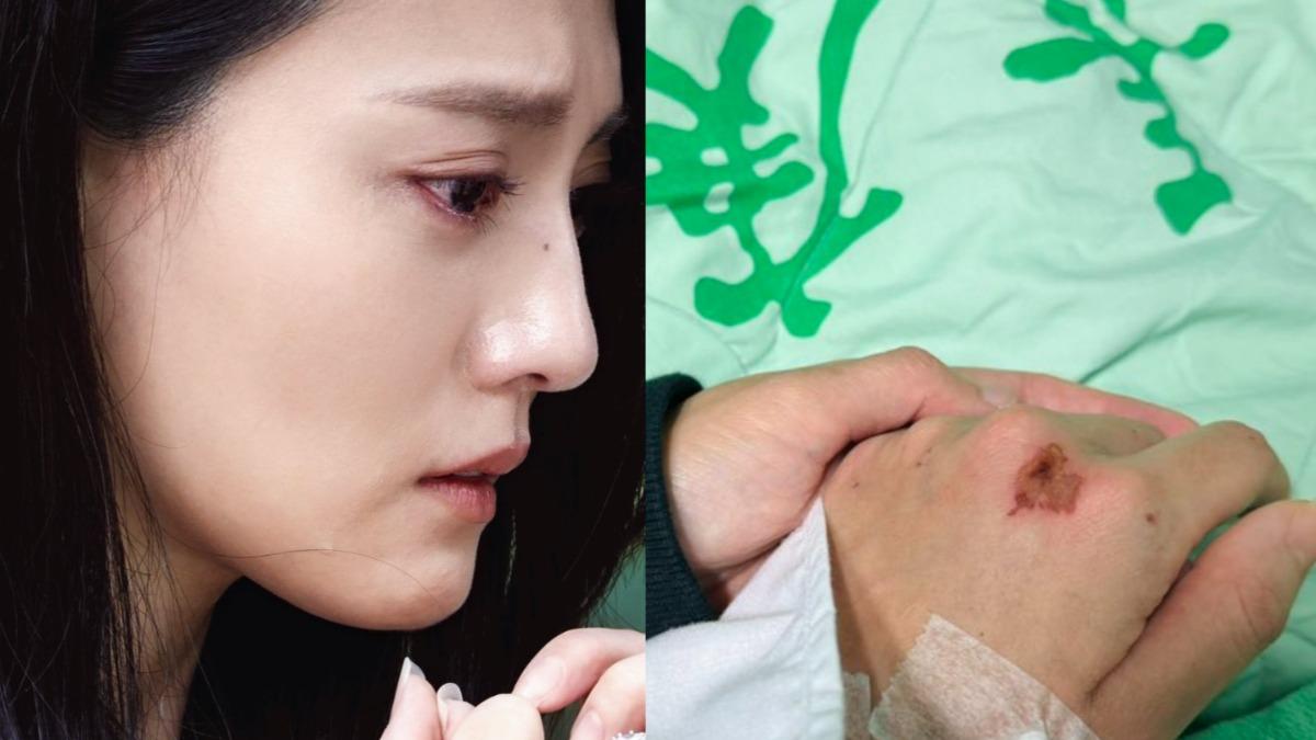 大結局前出車禍重傷!八點檔女神「被換角」悲喊:感受到無能為力