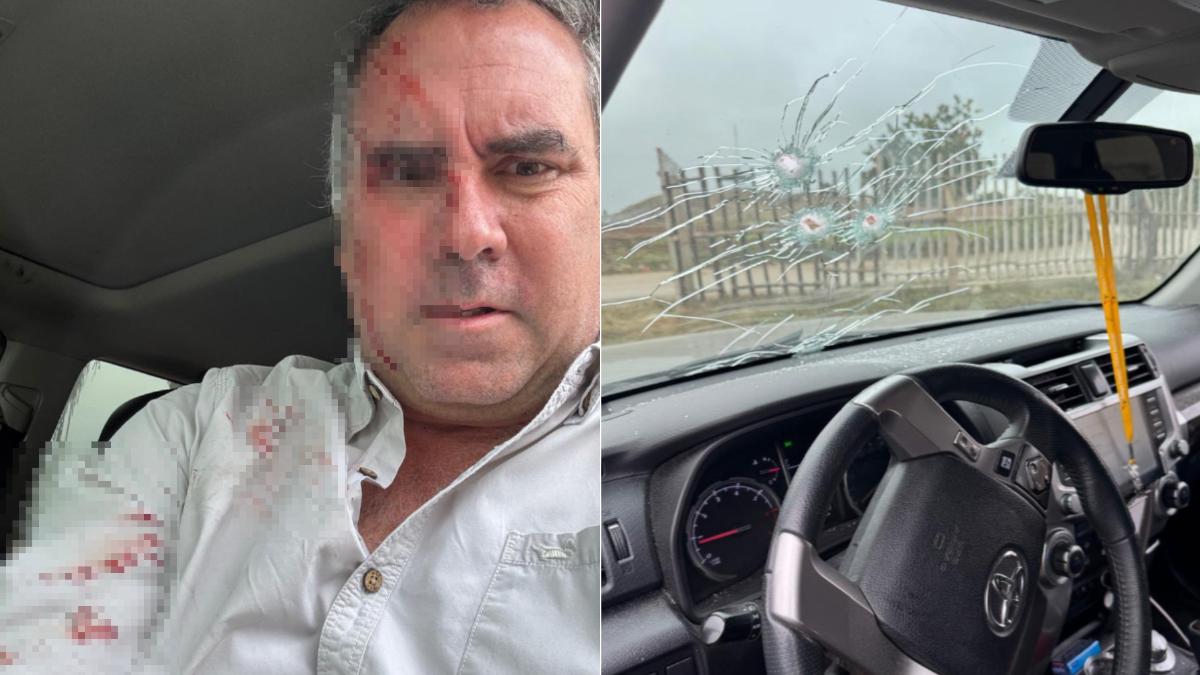 秘魯總統參選人遇歹徒槍擊！他開12槍反擊成功脫險　血跡照曝