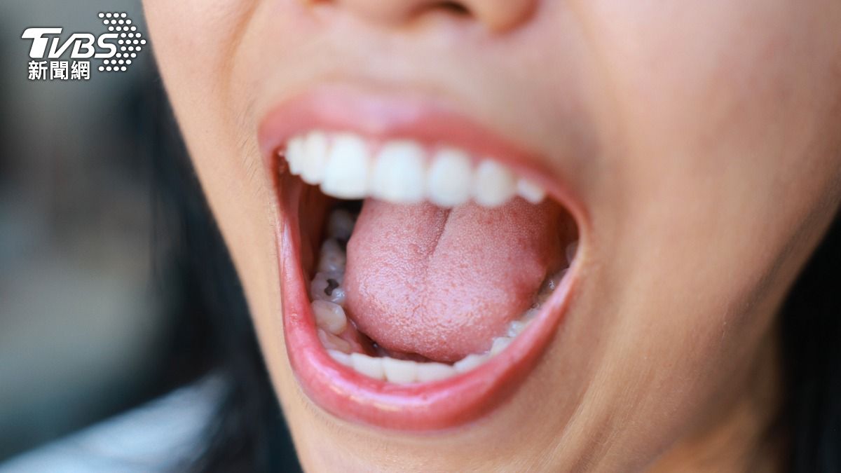 口腔癌早期難察覺！台大推「AI快篩」補破口：紅燈者1週內就醫