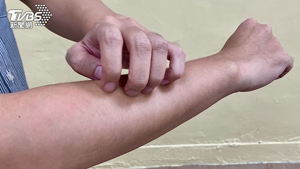 瘋狂抓不停？皮膚癢其實是身體「這部位」　開始拉警報