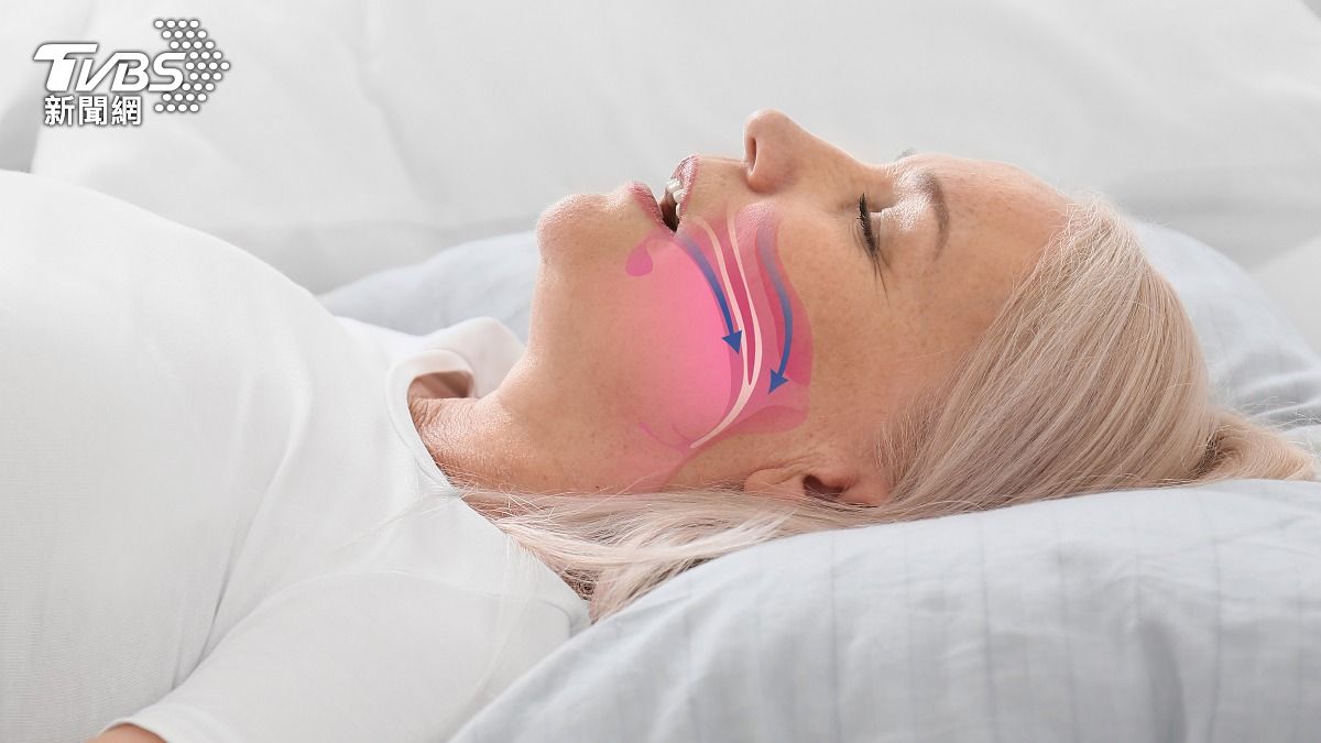 用嘴呼吸恐引發睡眠呼吸中止！醫曝「5大危害」：恐變醜、易生病