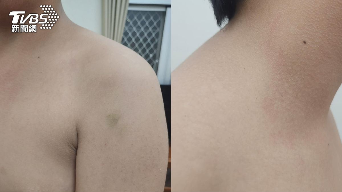 慶生變圍攻! 國中生被綁欄杆攻擊 全身是傷 家長提告