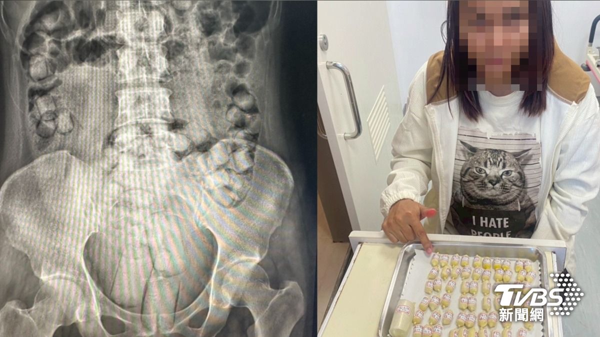 免費遊台還拿錢!2泰女「口吞塞肛」海洛因 體內驚藏百顆毒球