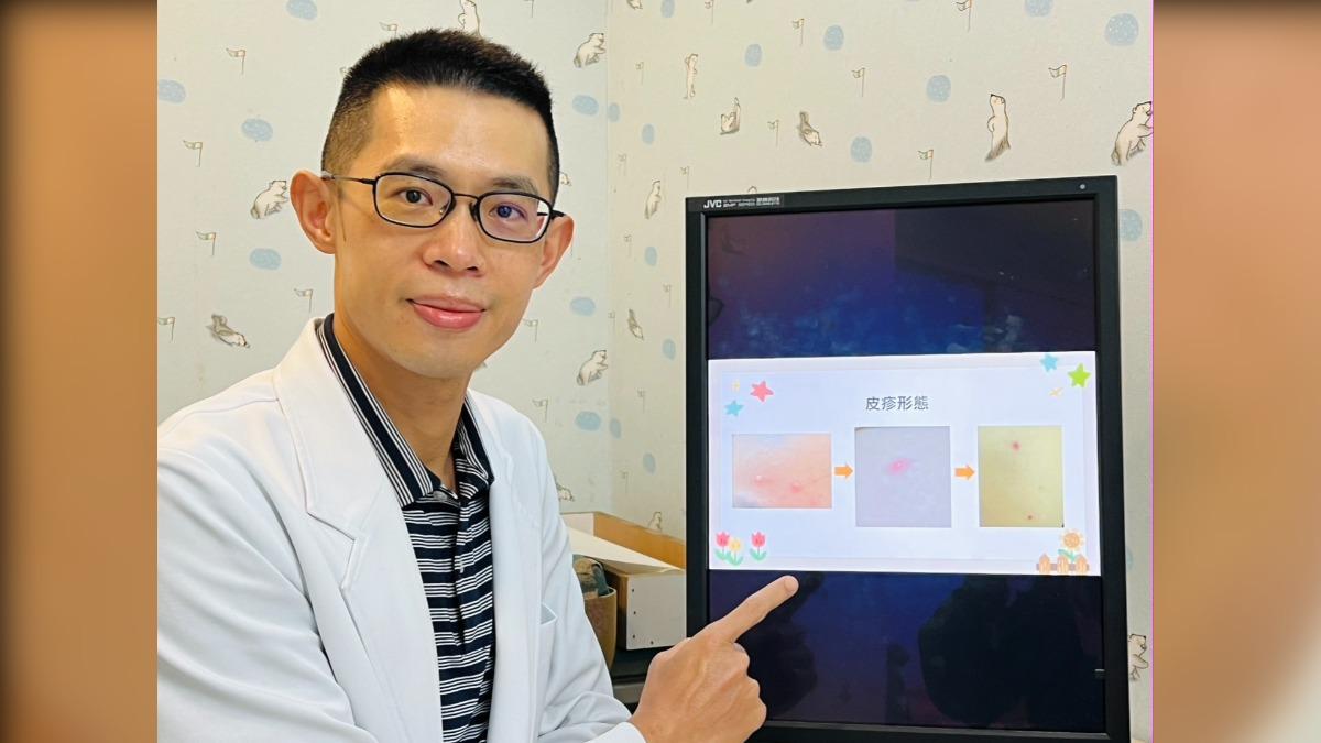 8歲童紅疹「誤當蟲咬」!3天未消確診水痘 醫:成人感染更危險