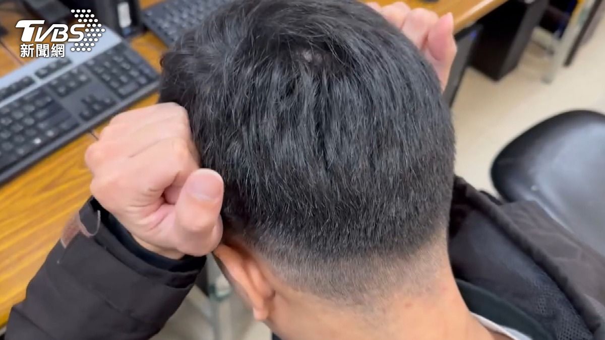 失眠、偏頭痛竟連動「大腦退化」!醫示警:「這物質」腦內堆積 恐加速失智