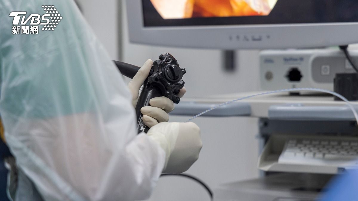 竟有無痛胃鏡!胃鏡常見Q&A一次看 健保、自費價差掀熱議