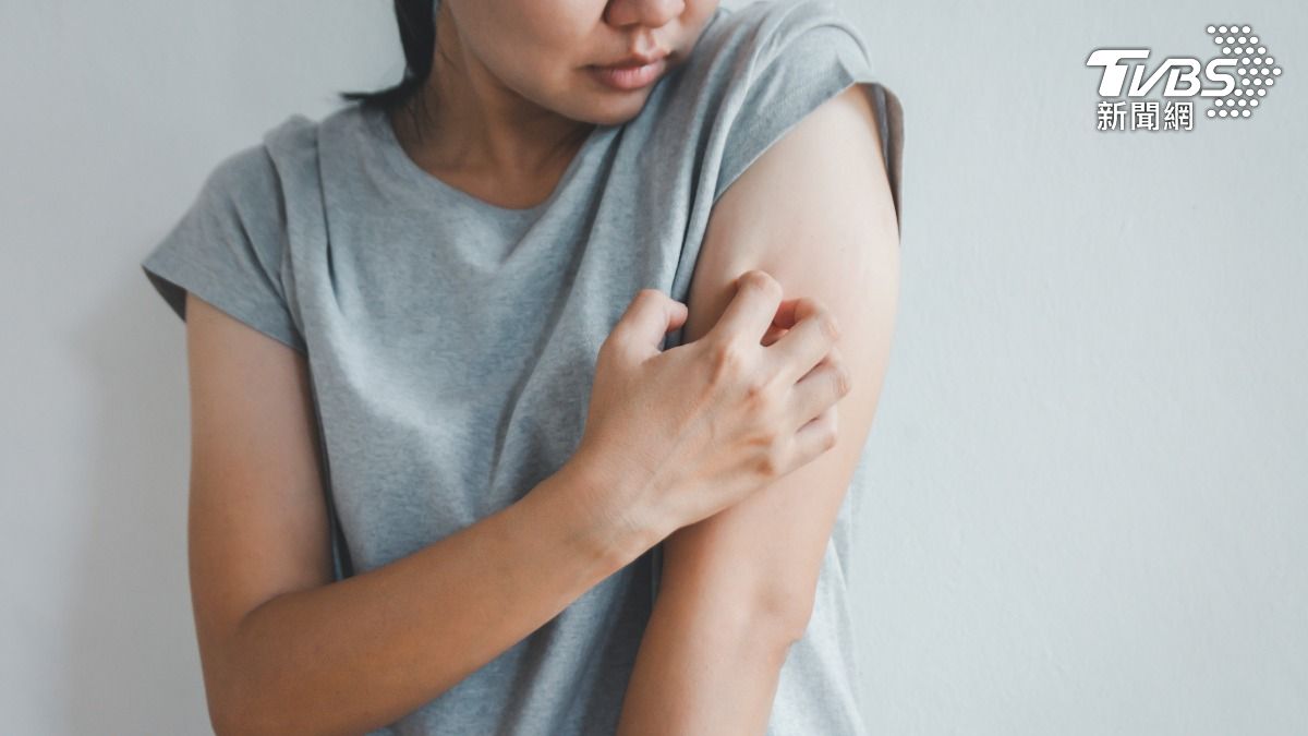 每天都在喝！2常見飲料竟是「皮膚地雷」　癢到受不了