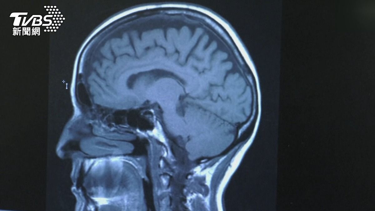 20、30歲就「早衰」?醫揭「這三種」NG行為 加速老化元凶!