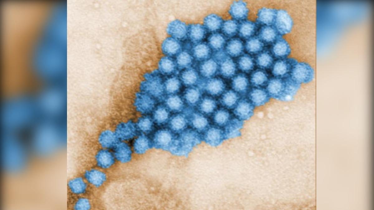 [新聞] 賴清德遭「嘔吐物攻擊」 恐染諾羅？ - 八卦 - PTT.BEST 批踢踢爆文 3