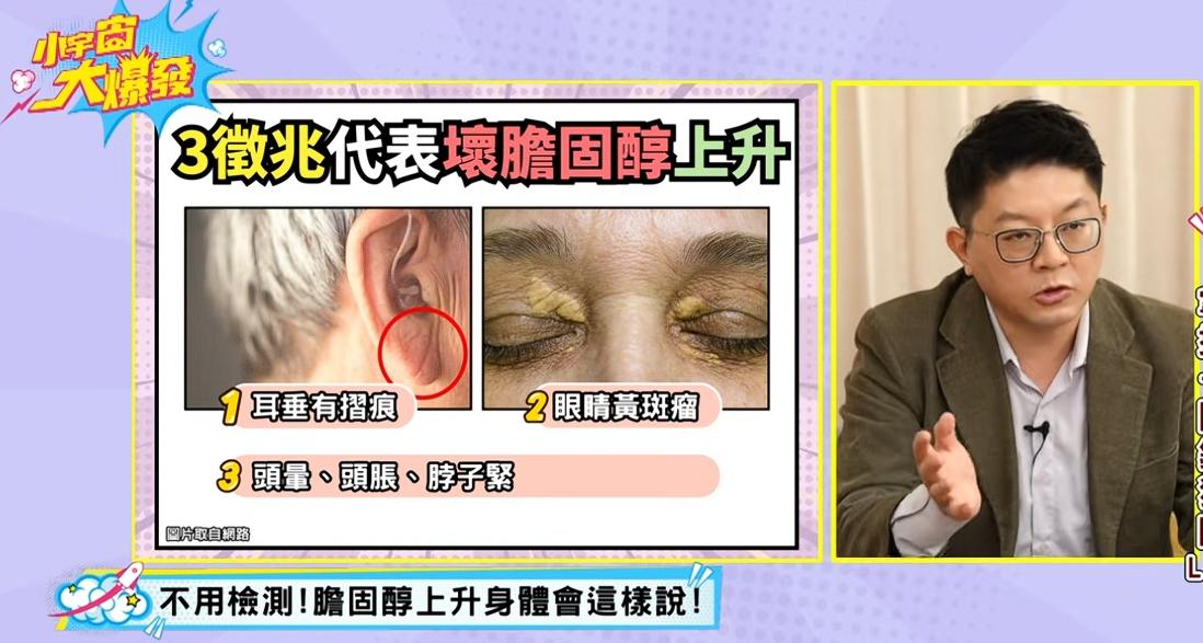 壞膽固醇超標警訊一次看。（圖／翻攝自YouTube MOMOTV綜合台）