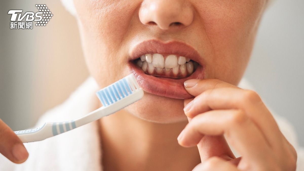 牙齦痛爆、刷牙流血!醫示警「恐掉牙、變牙周病」:1動作改善