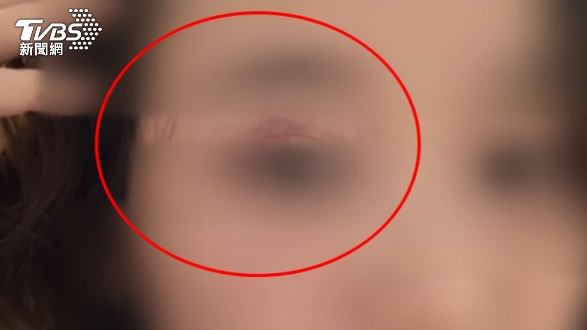 獨/女控遭前男友扯髮撞牆掐脖 全身傷分手後竟被討4萬卡費