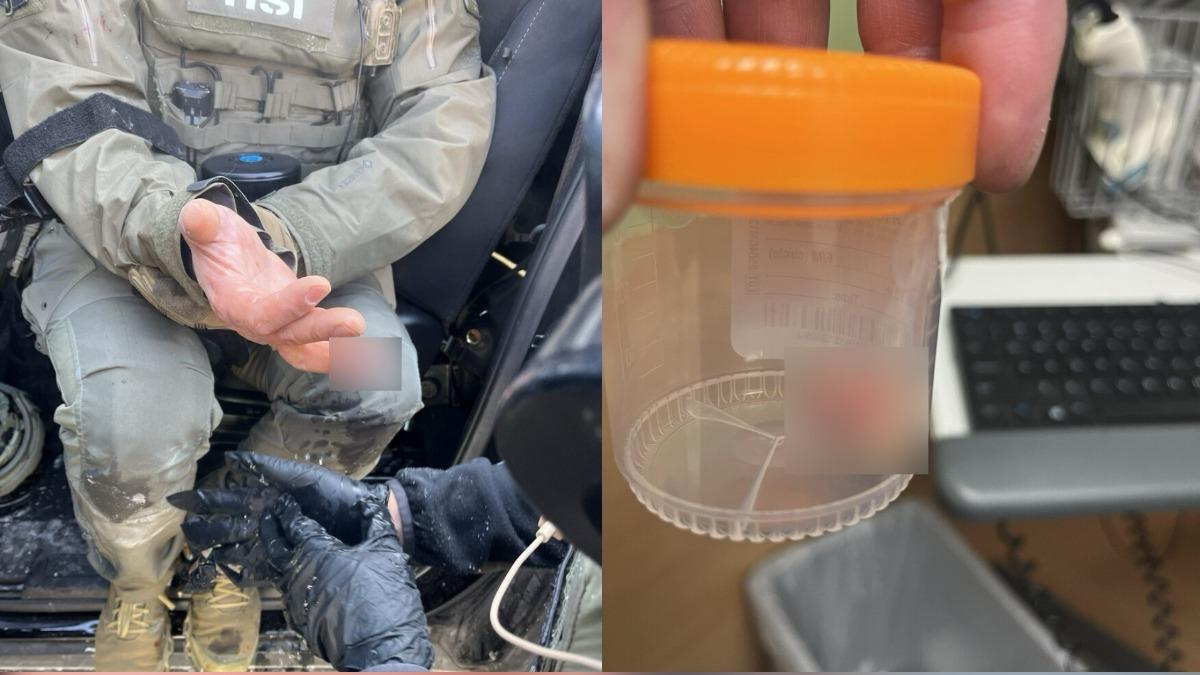 明州抗議升級!示威者咬掉探員手指 川普竟轉貼斷指爆血畫面