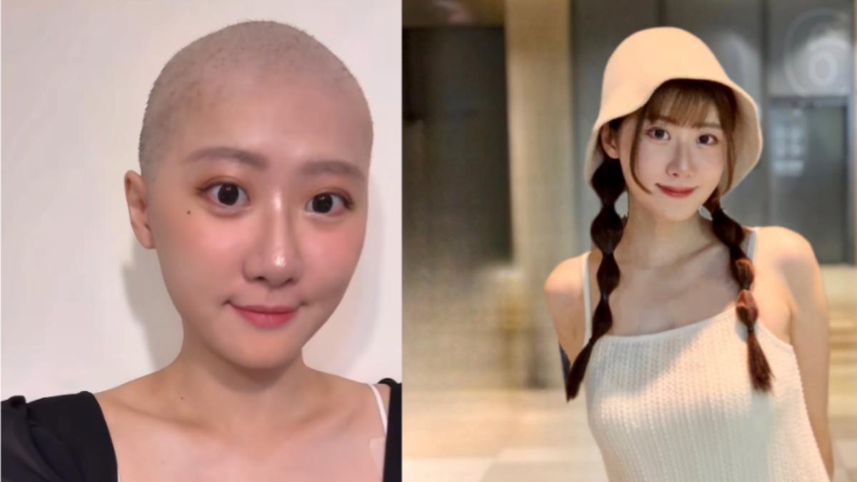 國光女神罹癌一度增20KG!化療半年「收入少5倍」:重新開始