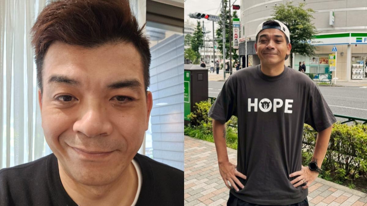 48歲史丹利「半邊臉麻痺」!病毒感染 嘴歪眼斜證實病況