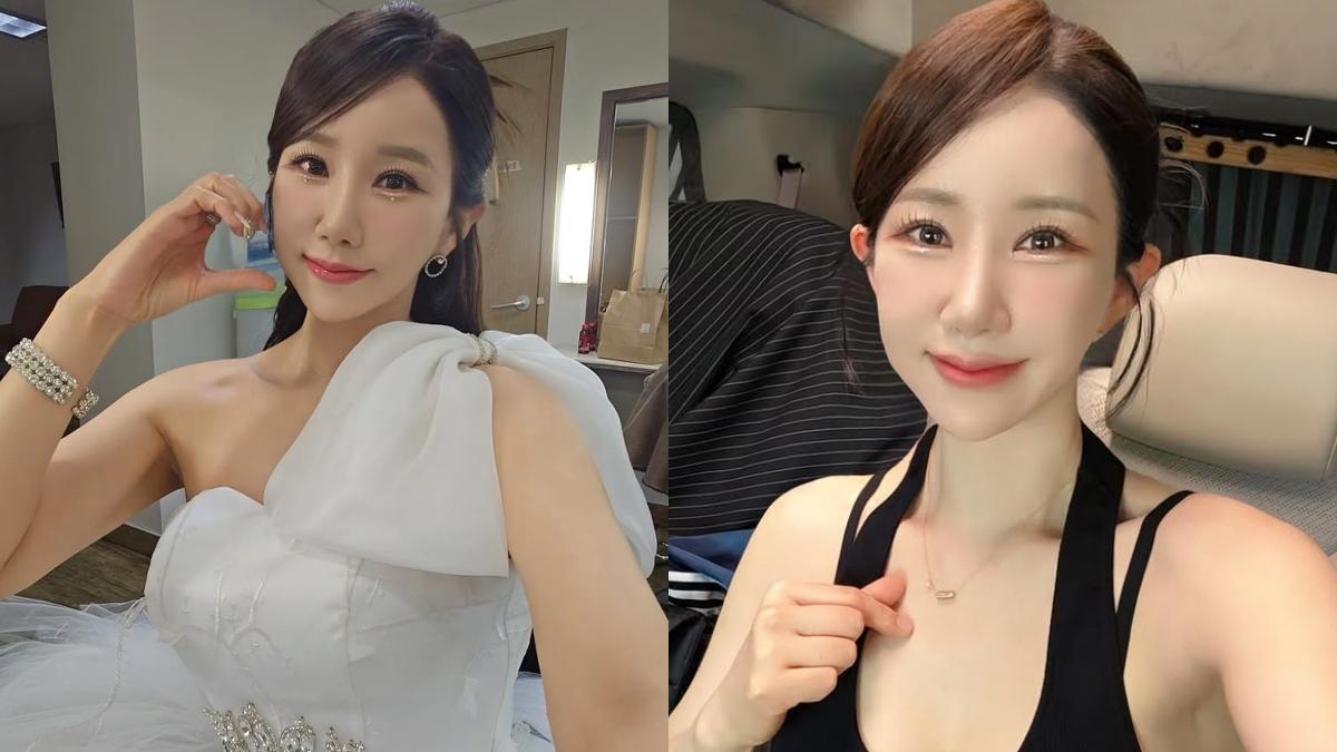 錄影途中頭炸痛!美魔女歌手「緊急送醫開刀」 驚人病因曝光了