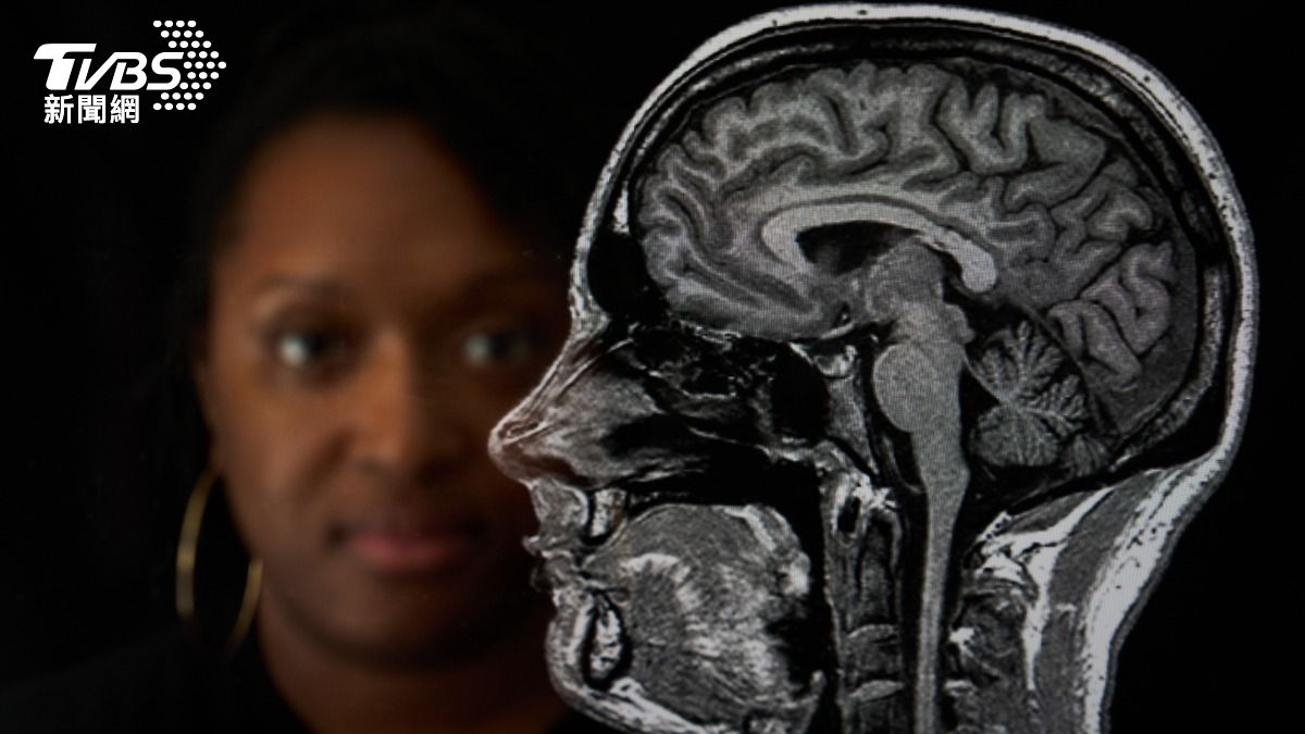 失智症有救了?45%失智症可預防 權威公布大腦健康妙招