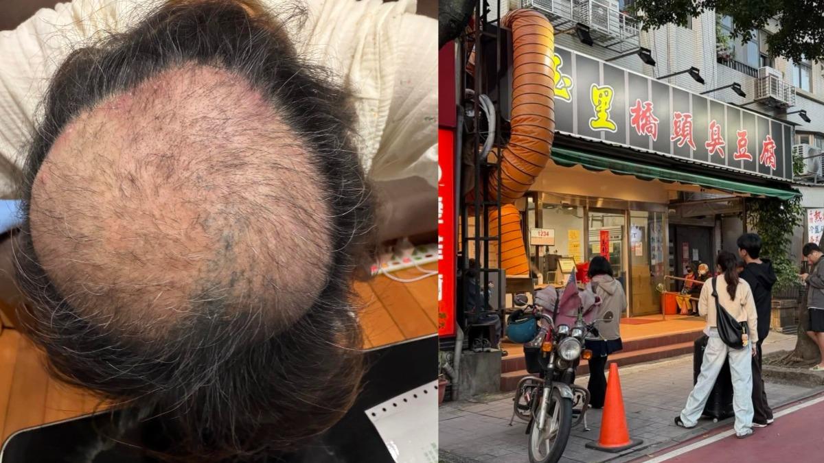 玉里橋頭臭豆腐飄屎味 拔髮女住戶曝無奈現況:好像要感謝我