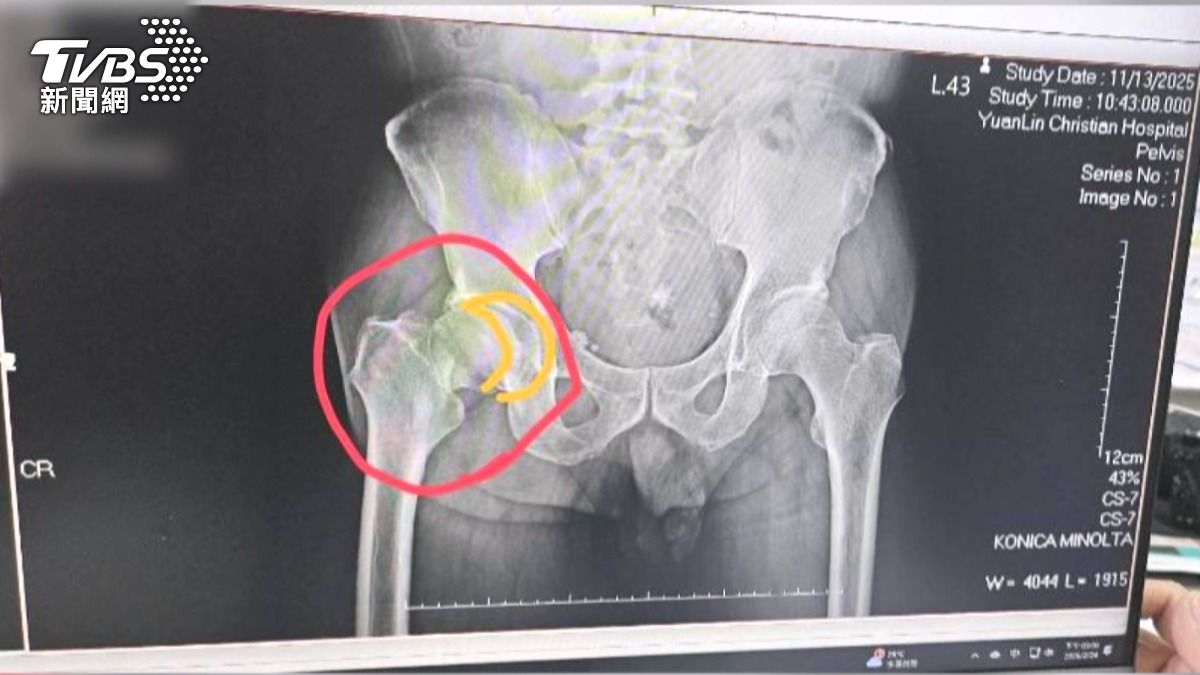 [新聞] 獨家影音／女兒當面撤自費項目！父仍被裝 - 八卦 - PTT.BEST 批踢踢爆文